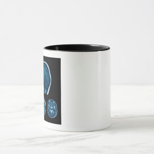 Mug Analyse Mri du cerveau (Centre)