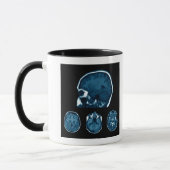 Mug Analyse Mri du cerveau (Gauche)