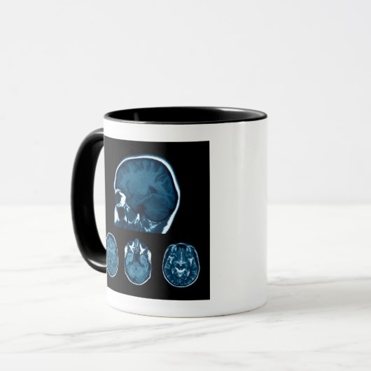 Mug Analyse Mri du cerveau (Devant gauche)