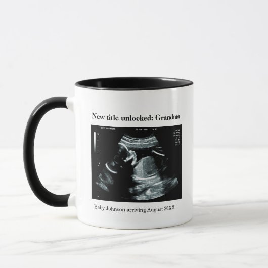 Mug Annonce de grossesse par échographie – Devenir gra (Gauche)