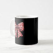 Mug arc (Devant gauche)
