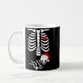 Mug Baby Shower Skeleton Christmas Santa Pregnancy Ann (Gauche)