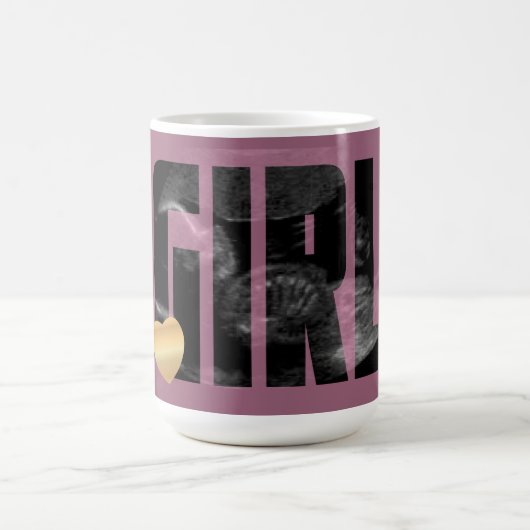 Mug Bébé fille Faire-part - Sonogramme avec DO-IT-YOUR (Centre)