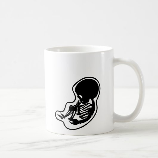 MUG BÉBÉ SQUELETTIQUE (Droite)