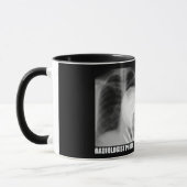 MUG BOMBE PHOTO DE RADIOLOGUE (Gauche)