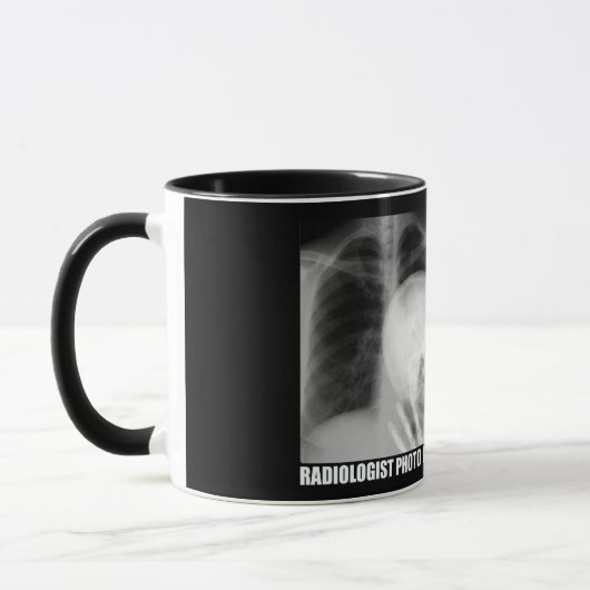MUG BOMBE PHOTO DE RADIOLOGUE (Gauche)