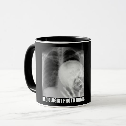 MUG BOMBE PHOTO DE RADIOLOGUE (Devant gauche)