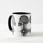 Mug Canette Radiologique (Devant gauche)