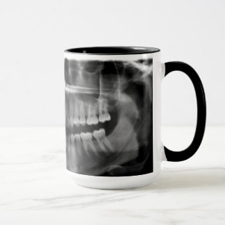 Mug Canette Rayons X Radiologie