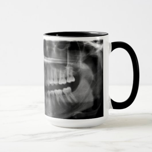 Mug Canette Rayons X Radiologie (Droite)