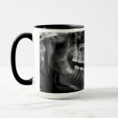 Mug Canette Rayons X Radiologie (Gauche)