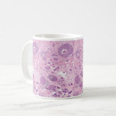 Mug Cellules cancéreuses de Tasse-Sein de café (Devant gauche)