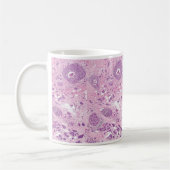 Mug Cellules cancéreuses de Tasse-Sein de café (Gauche)