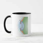 Mug Chirurgie de cataracte (Gauche)