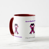 Mug Conscience chronique de migraine (Devant gauche)