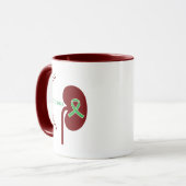 Mug de greffe de rein personnalisable (Devant gauche)