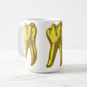 Mug Dent en or (Devant gauche)