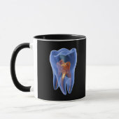 Mug Dent, section transversale transparente d'une (Gauche)