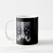 Mug Egirl Xray Squelette rose Papillon Harajuku y2k Da (Gauche)