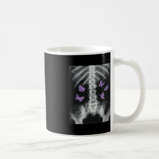 Mug Egirl Xray Squelette rose Papillon Harajuku y2k Da