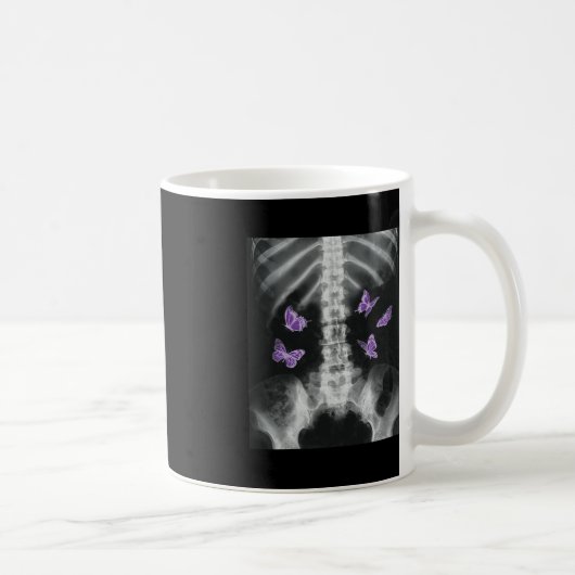 Mug Egirl Xray Squelette rose Papillon Harajuku y2k Da (Droite)