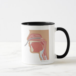 Mug Endoscopie du nez