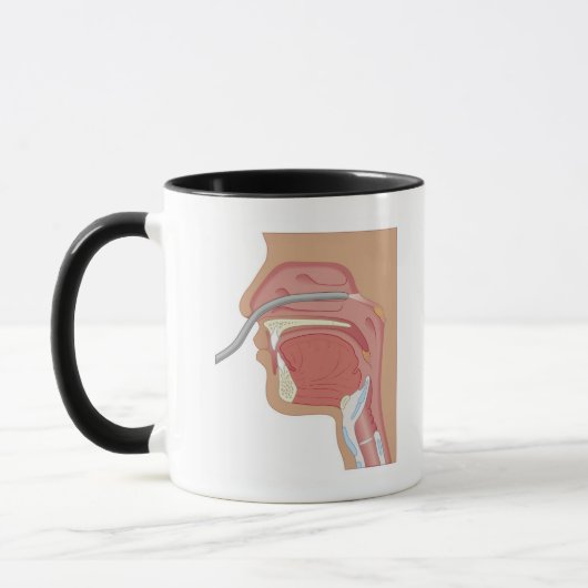 Mug Endoscopie du nez (Gauche)
