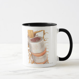 Mug Fermez-vous d'un disque invertebral dans l'épine