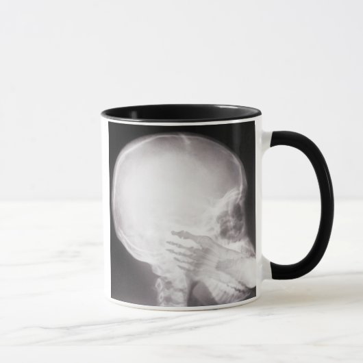 Mug Foot à Mouth X-Ray (Droite)