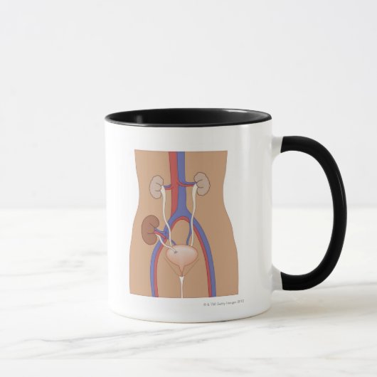 Mug Greffe de rein (Droite)