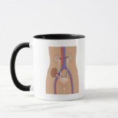 Mug Greffe de rein (Gauche)