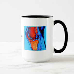 Mug IRM de genou