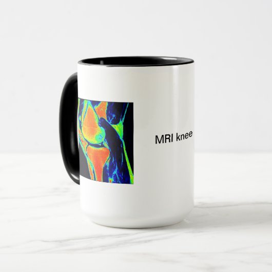 Mug IRM de genou (Devant gauche)