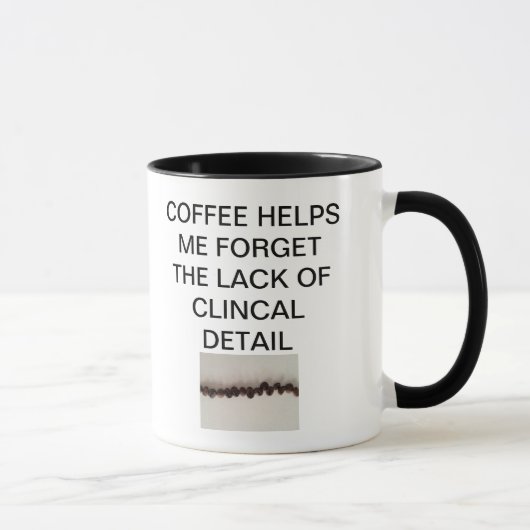 MUG LE CAFÉ M'AIDE À OUBLIER LE MANQUE DE DÉTAIL (Droite)