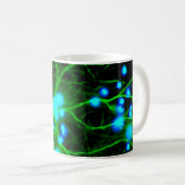 Mug Les Astrocytes sont des cellules globulaires en fo (Devant droit)