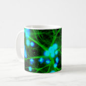 Mug Les Astrocytes sont des cellules globulaires en fo (Devant gauche)