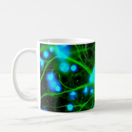 Mug Les Astrocytes sont des cellules globulaires en fo (Gauche)