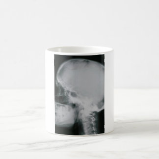 Mug Magique Crâne de rayon X