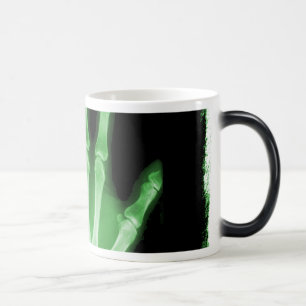 Mug Magique Main verte de squelette de rayon X