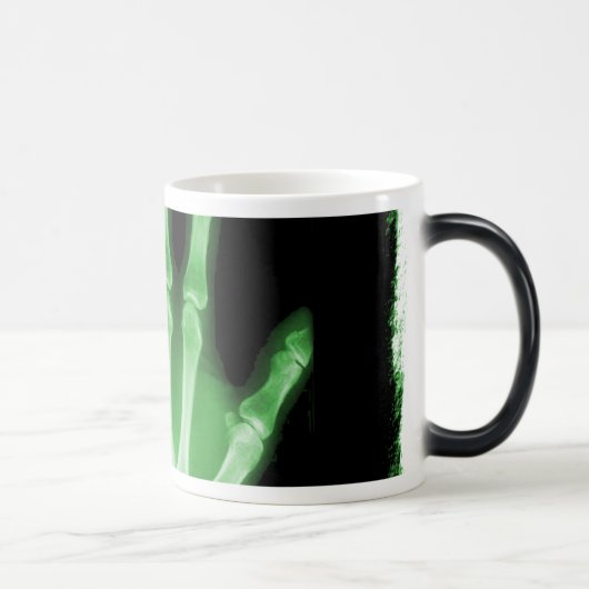Mug Magique Main verte de squelette de rayon X (Droite)