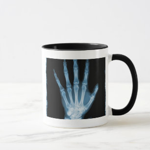 Mug Main bleue de squelette de rayon X