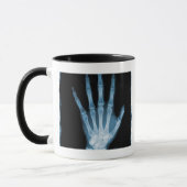 Mug Main bleue de squelette de rayon X (Gauche)