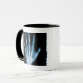 Mug Main bleue de squelette de rayon X (Devant gauche)