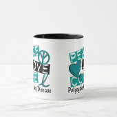 Mug Maladie rénale Polycystic du traitement PKD (Centre)