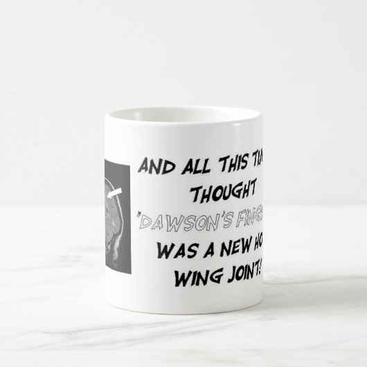 Mug Obtenez personnel avec votre charge de lésion ! (Centre)