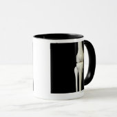 Mug Os du genou 4 (Devant droit)