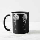 Mug Ponction lombaire (Gauche)