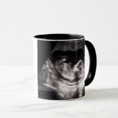 Mug Première Fête des pères Bébé Sonogramme Ultrasound (Devant droit)