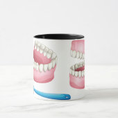 Mug Prothèses dentaires complètes et soins dentaires a (Centre)