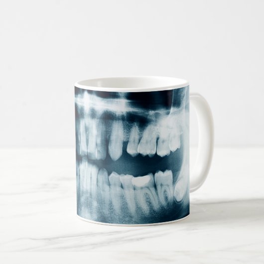 Mug Rayon X des dents (Devant droit)